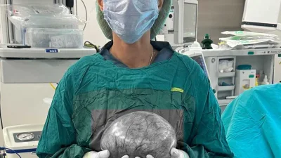 Yozgat Şehir Hastanesi’nde 30 yaşındaki bir kadının karnından, 20 cm