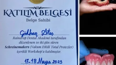 Boğazlıyan’daki Derman Diş Kliniği, dişsiz hastalar için geliştirilen ve protez