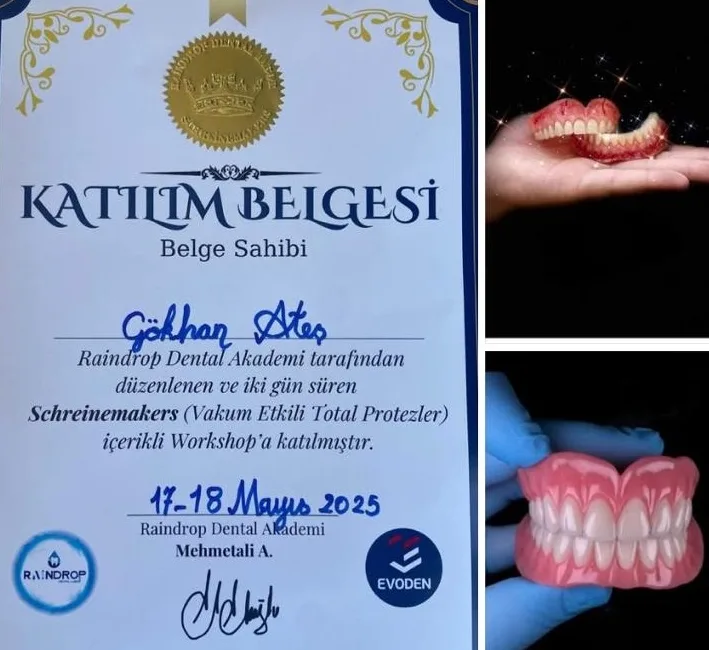 Boğazlıyan’daki Derman Diş Kliniği, dişsiz hastalar için geliştirilen ve protez