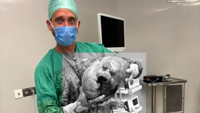 Yozgat Şehir Hastanesi’nde yapılan ameliyatla, karın ağrısı şikayetiyle başvuran yaşlı